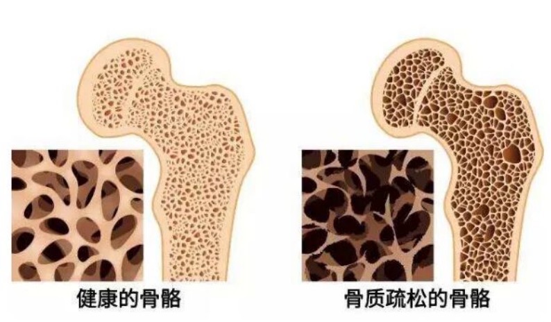 WeChat438a976b54aad30cd5f1cdb3c9f7c6c6.jpg